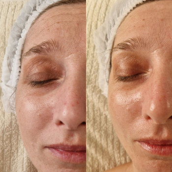 Фото с портфолио En Ajoure