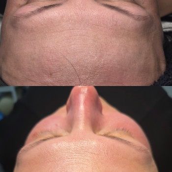 Фото с портфолио Он Ажур