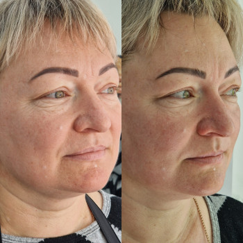 Фото с портфолио En Ajoure