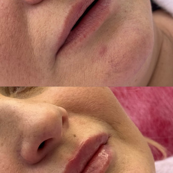 Фото с портфолио Римма Черепаха