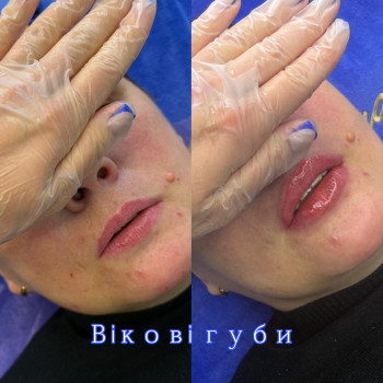 Фото с портфолио Римма Черепаха