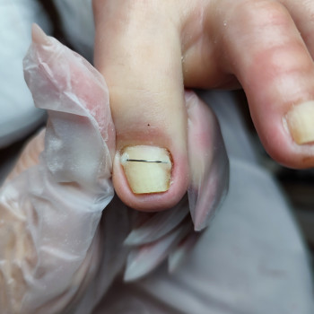 Фото с портфолио Ірина Мочкодан