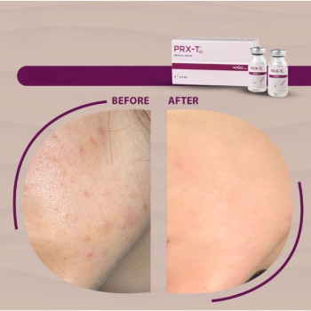 Фото с портфолио Катерина Сіліна