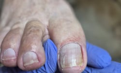 Педикюр медичний (від подолога) Подолог Ольга Одеса