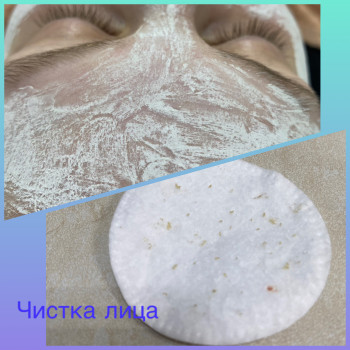 Чистка обличчя