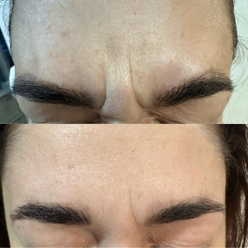 Фото с портфолио Inspira Clinic Health & Beauty