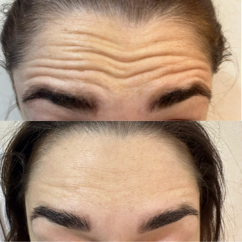 Фото с портфолио Inspira Clinic Health & Beauty