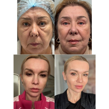 Фото с портфолио Вікторія Олександрівна Кушнір