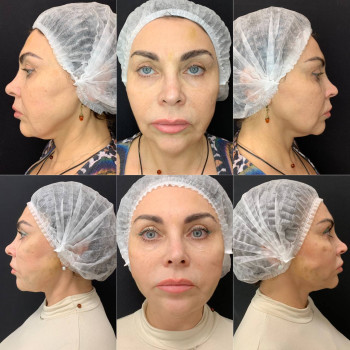 Фото с портфолио Виктория Александровна Кушнир