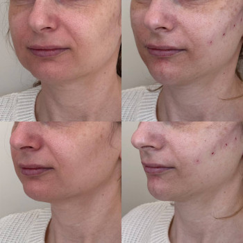 Фото с портфолио Виктория Александровна Кушнир