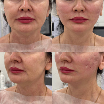 Фото с портфолио Виктория Александровна Кушнир