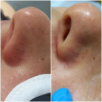 Фото с портфолио Виктория Александровна Кушнир