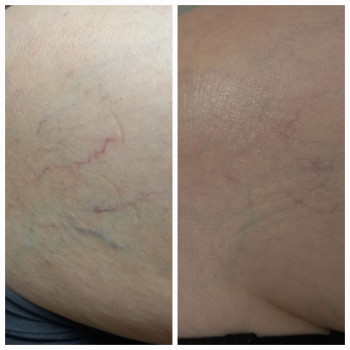 Фото с портфолио Виктория Александровна Кушнир