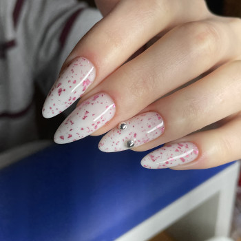 укріплення гелем