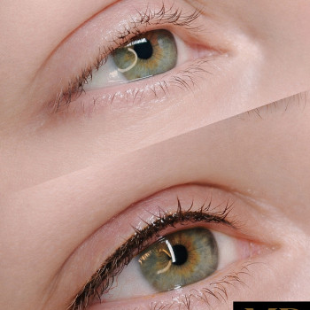 Заповнення міжвійного простору