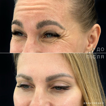 Фото с портфолио Филипп Кравченко