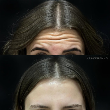 Фото с портфолио Филипп Кравченко