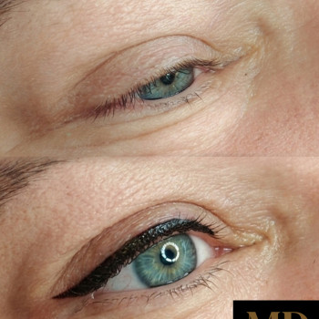 Класична стрілочка