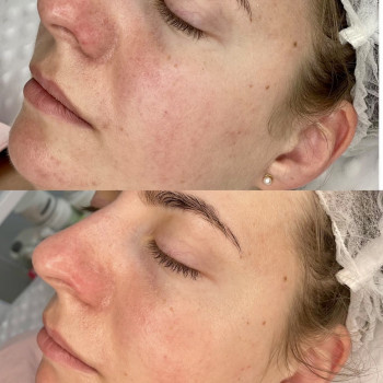 Фото с портфолио Ольга Гринько