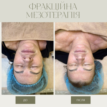 Фото с портфолио Тетяна Скрипка