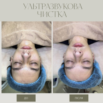 Фото с портфолио Тетяна Скрипка