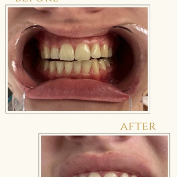 Фото с портфолио Тетяна Скрипка