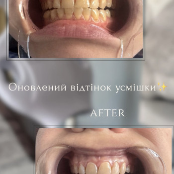 Фото с портфолио Тетяна Скрипка