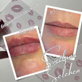 Фото с портфолио Светлана Селегень