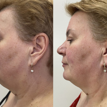 Фото с портфолио Светлана Селегень