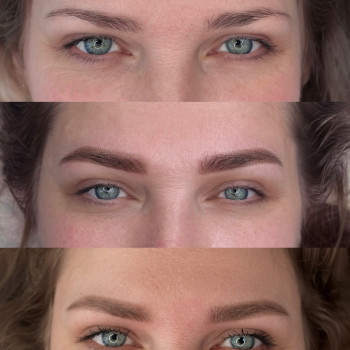 До, одразу після та Загоєні. Пудрові брови