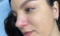 Пирсинг крыла носа Майстер з пірсингу Татьяна Київ