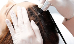 Трихоскопія шкіри голови та волосся Врач-косметолог Юлія Луцк