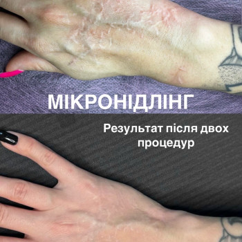 Фото с портфолио Вікторія Яремчук