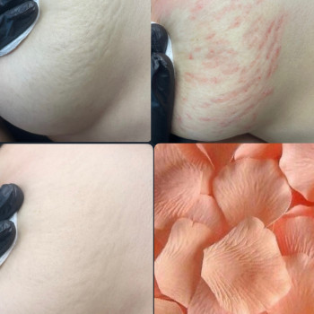 Фото с портфолио Вікторія Яремчук