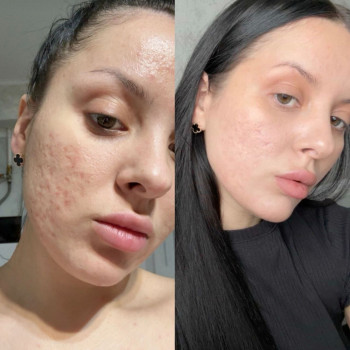 Фото с портфолио Вікторія Яремчук