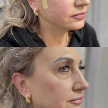 Фото с портфолио Любов Чумаченко