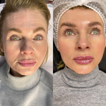 Фото с портфолио Любов Чумаченко