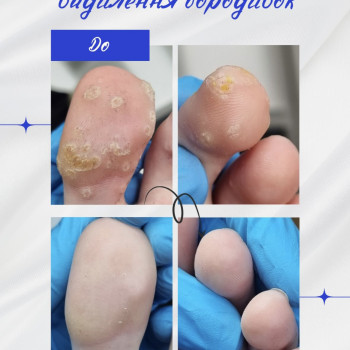 Фото с портфолио Твоя стопа