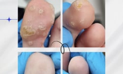  Центр подологии Твоя стопа Львов