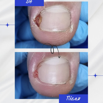 Фото с портфолио Твоя стопа