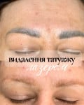 Знижка на лазерне  видалення неякісного татуажу Мастер татуажа Ольга Черкассы