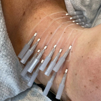 Фото с портфолио Ирина Чуевская