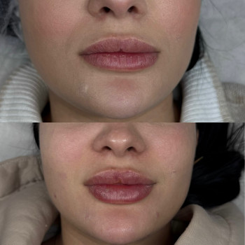 Фото с портфолио Ксенія Рубльова