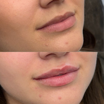 Фото с портфолио Ксенія Рубльова