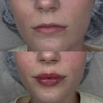 Фото с портфолио Ксенія Рубльова