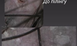 Пилинг кожи Перукар Яна Київ