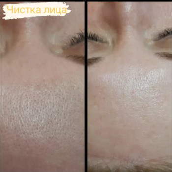 Фото с портфолио Ярина Сенченко