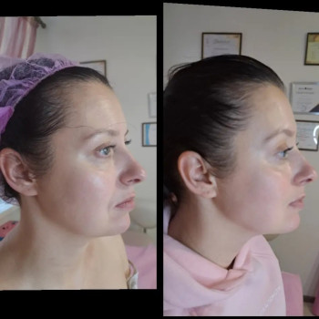 Фото с портфолио Ярина Сенченко