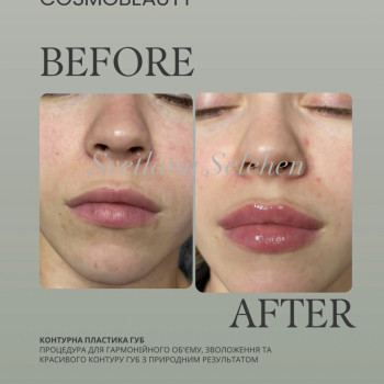 Фото с портфолио Світлана Селегень