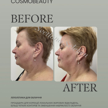 Фото с портфолио Світлана Селегень